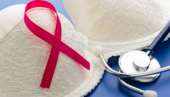 Breast Cancer Related Lymphedema Frequently Asked Questions