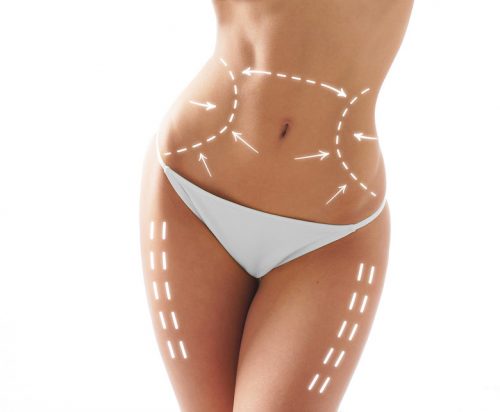 Liposuction Surgical Recovery Therapy - Post-Operative Recovery Therapy after Cosmetic Surgery Albuquerque Torso and Legs