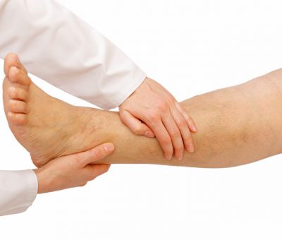 manual lymphatic drainage for lymphedema Albuquerque