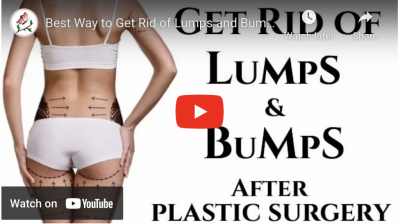 How to Get Rid of Lumps and Bumps After Plastic Surgery Lipo BBL Tummy Tuck